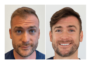 3. See a Visible Transformation